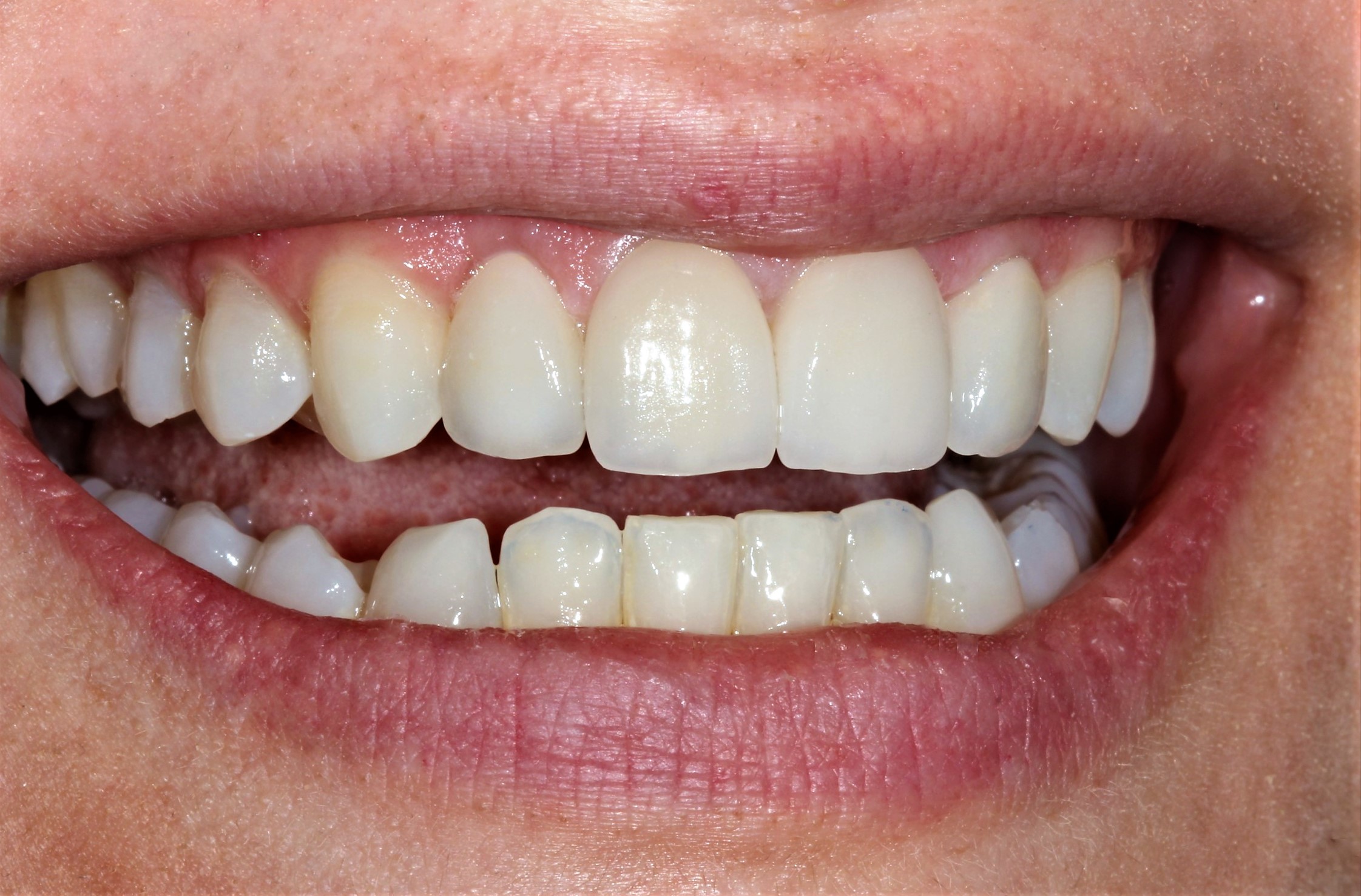 Mogu li ja imati ljepši osmijeh?