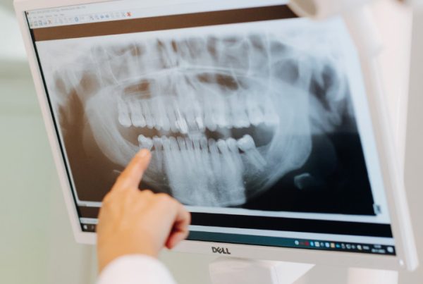 ortopantomogram dijagnostički snimak