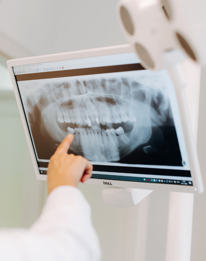 ortopantomogram dijagnostički snimak