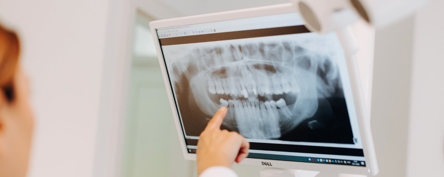 Endodoncija