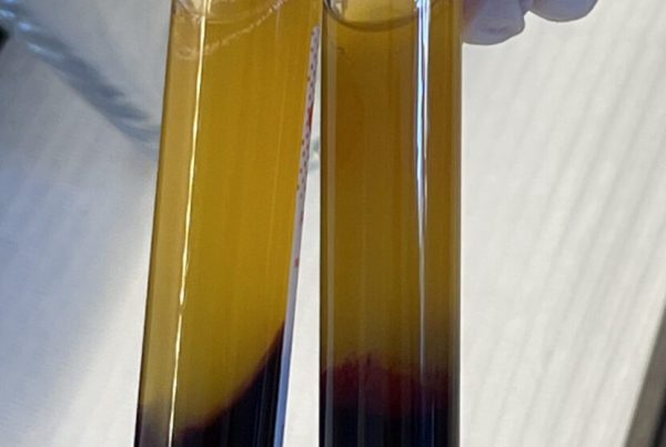 epruvete sa PRF matičnim stanicama