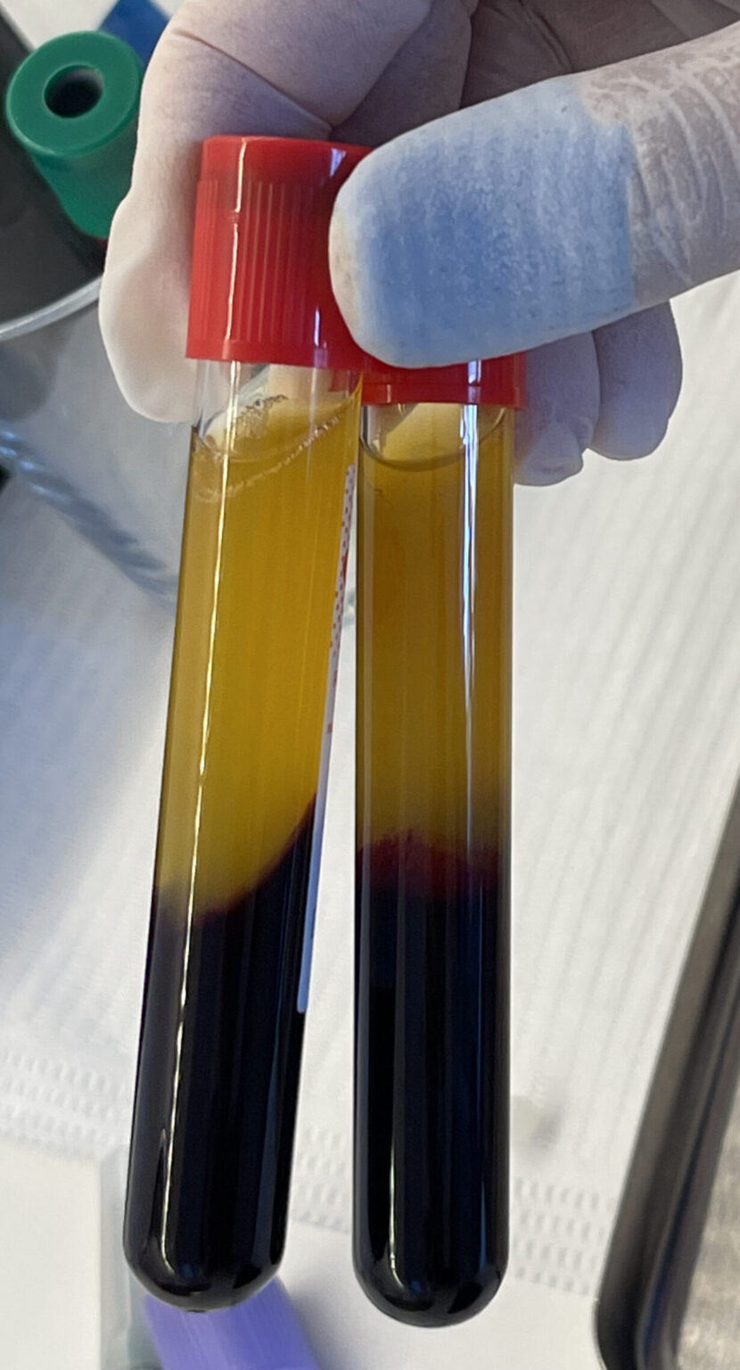 epruvete sa PRF matičnim stanicama