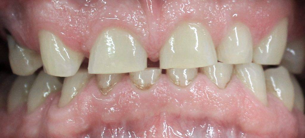 Neuromodulator u stomatologiji