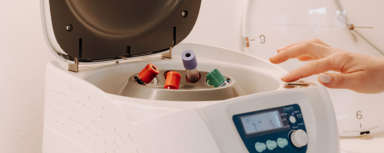 PRF prirodni način pomlađivanja