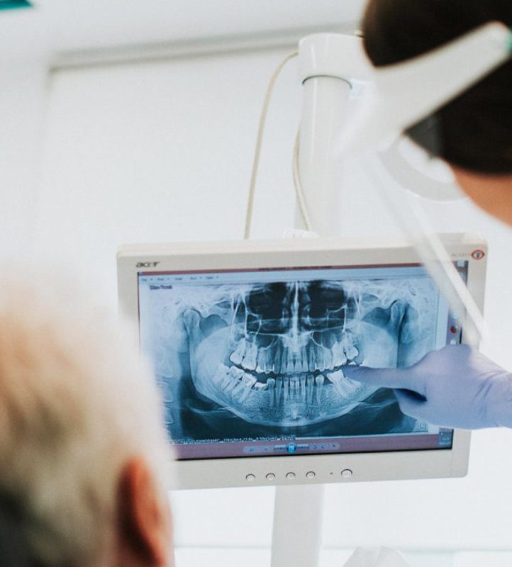 pregled rtg snimke na stomatološkom stolcu