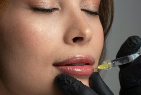 primjena dermalnog filera u usnice